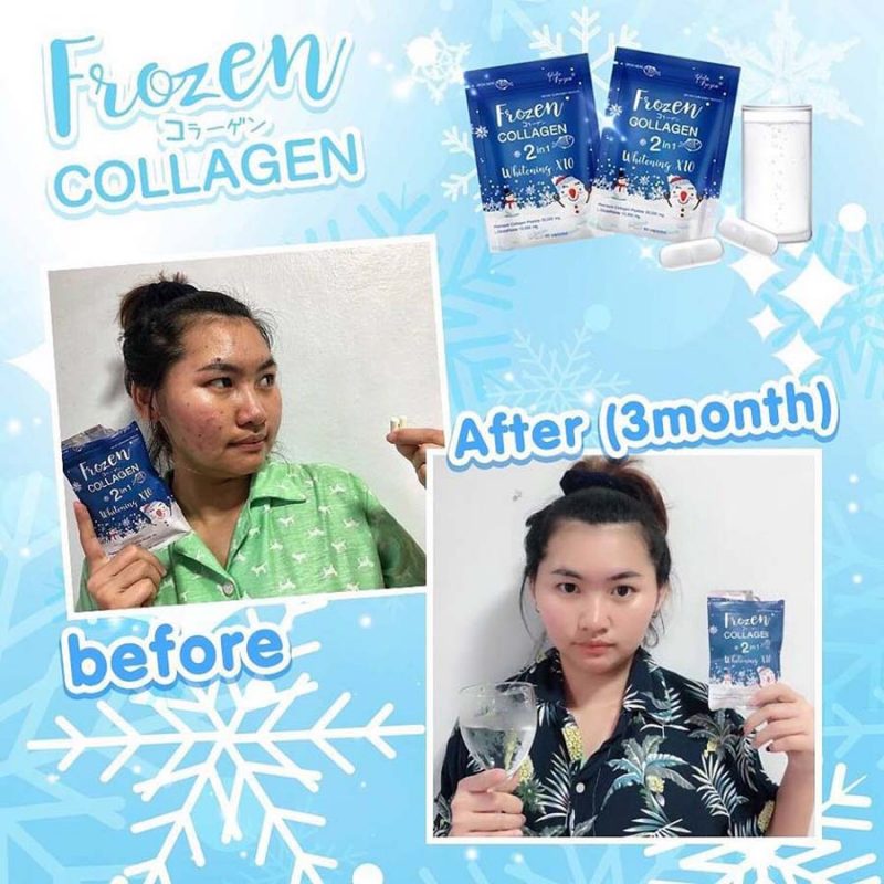 Frozen collagen supplement